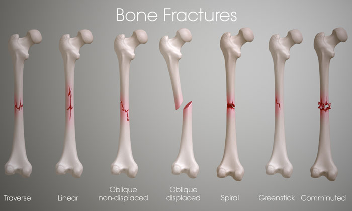 Best Orthopaedic Surgeon in Hyderabad