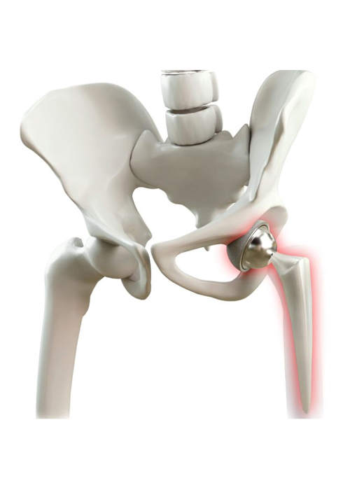 Best Orthopaedic Surgeon in Hyderabad