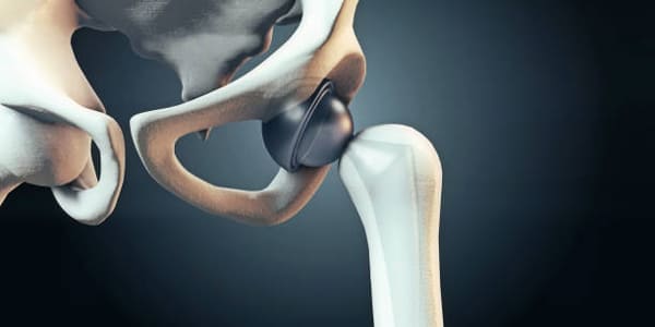 Best surgeon in Hyderabad