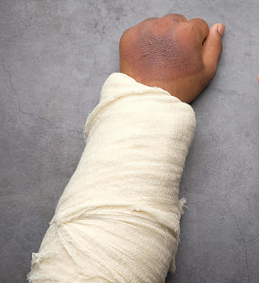 Knee Joint Arthroplasty